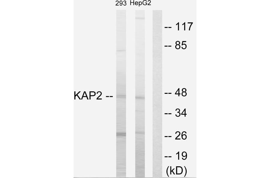 Western Blot - Anti-KAP2 Antibody (C10363) - Antibodies.com