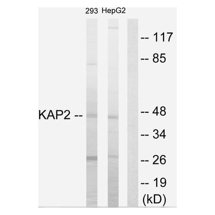 Western Blot - Anti-KAP2 Antibody (C10363) - Antibodies.com