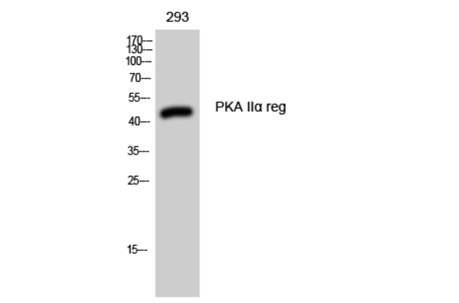 Western Blot - Anti-KAP2 Antibody (C10363) - Antibodies.com