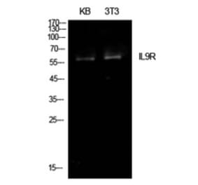 Western Blot - Anti-IL9R Antibody (C30427) - Antibodies.com