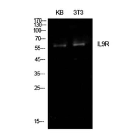 Western Blot - Anti-IL9R Antibody (C30427) - Antibodies.com