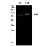 Western Blot - Anti-IL9R Antibody (C30427) - Antibodies.com