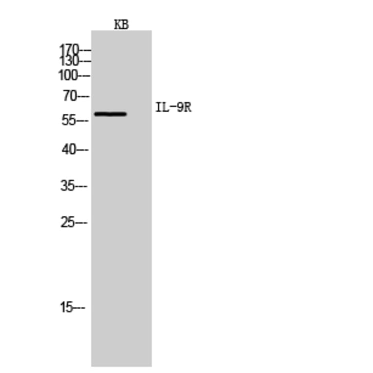 Western Blot - Anti-IL9R Antibody (C30427) - Antibodies.com