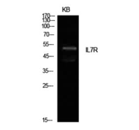 Western Blot - Anti-IL7R Antibody (C30426) - Antibodies.com