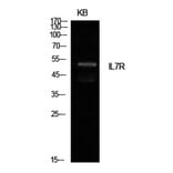 Western Blot - Anti-IL7R Antibody (C30426) - Antibodies.com