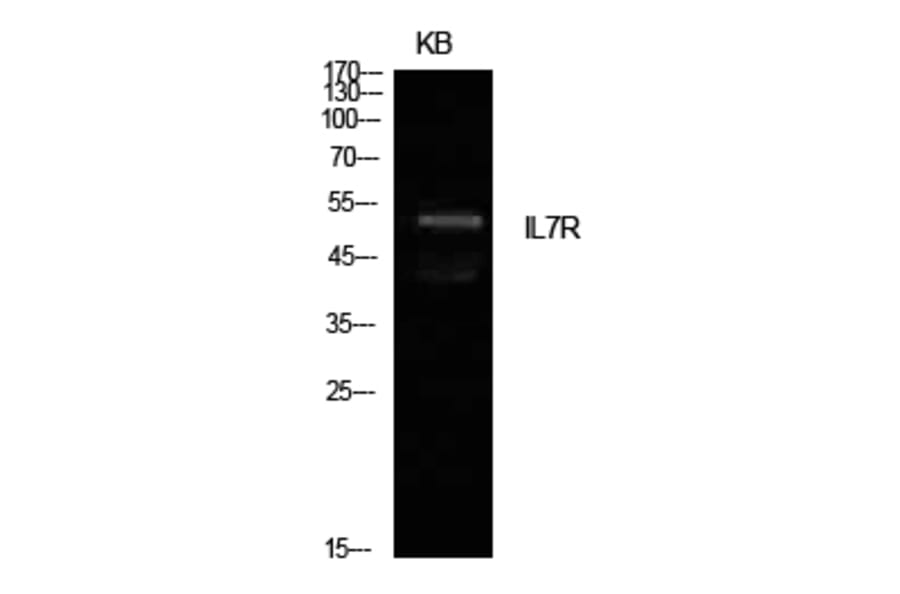 Western Blot - Anti-IL7R Antibody (C30426) - Antibodies.com