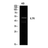 Western Blot - Anti-IL7R Antibody (C30426) - Antibodies.com