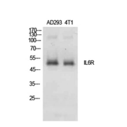 Western Blot - Anti-IL6R Antibody (C30041) - Antibodies.com