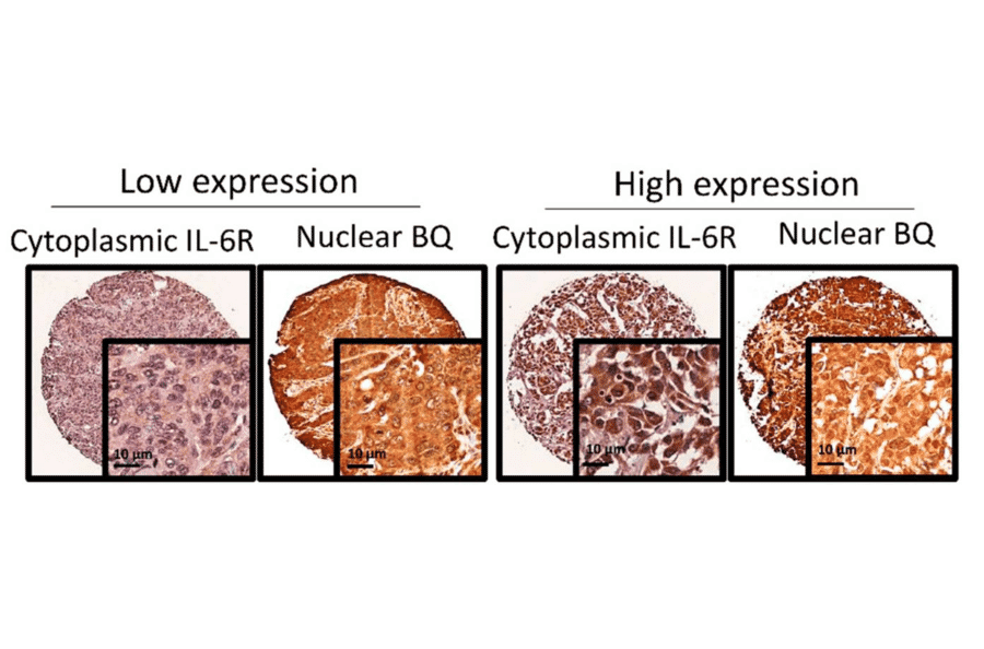 Immunohistochemistry - Anti-IL6R Antibody - Antibodies.com