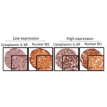 Immunohistochemistry - Anti-IL6R Antibody - Antibodies.com