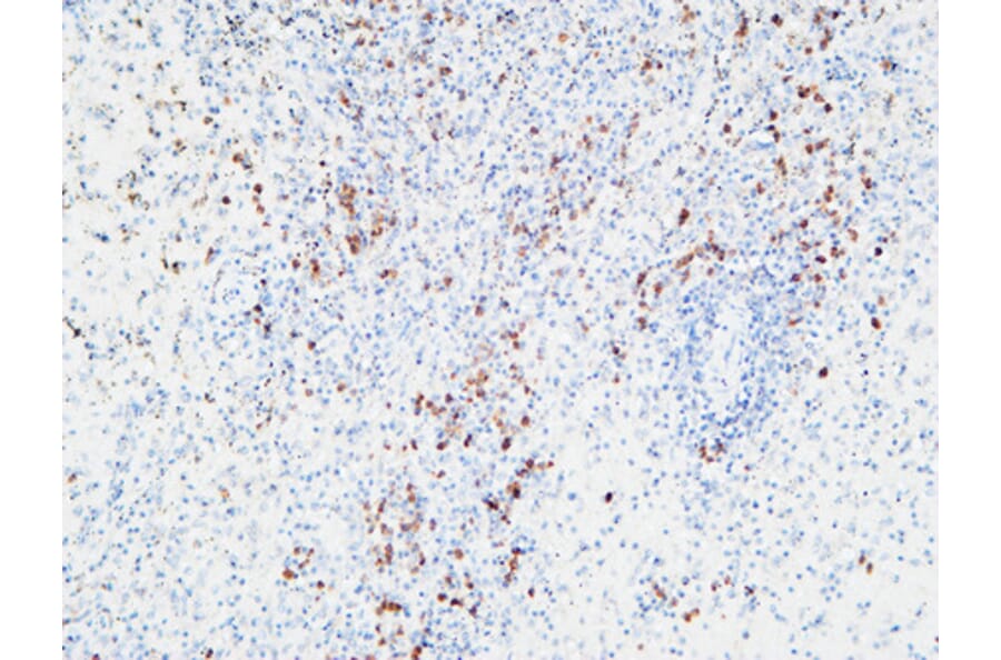 Immunohistochemistry - Anti-IL6R Antibody (C30041) - Antibodies.com