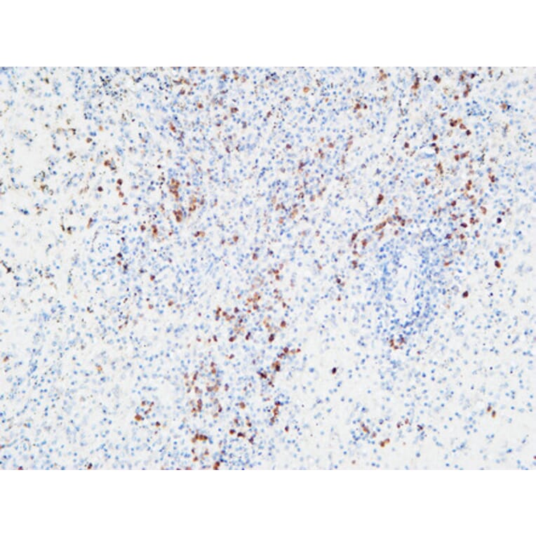 Immunohistochemistry - Anti-IL6R Antibody (C30041) - Antibodies.com