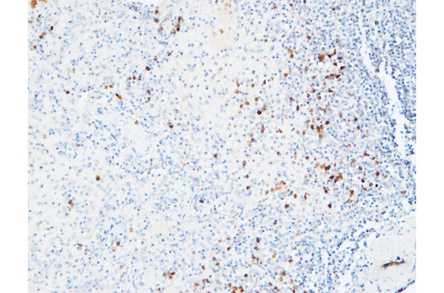 Immunohistochemistry - Anti-IL6R Antibody (C30041) - Antibodies.com