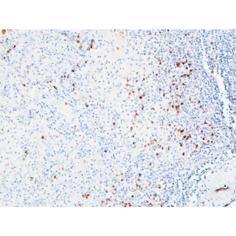 Immunohistochemistry - Anti-IL6R Antibody (C30041) - Antibodies.com