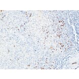 Immunohistochemistry - Anti-IL6R Antibody (C30041) - Antibodies.com