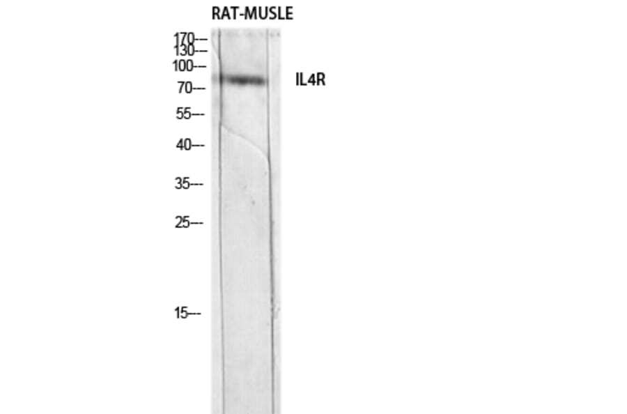 Western Blot - Anti-IL4R Antibody (C30425) - Antibodies.com