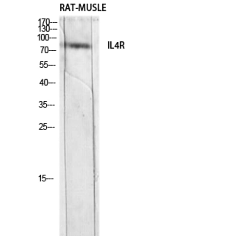 Western Blot - Anti-IL4R Antibody (C30425) - Antibodies.com