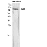 Western Blot - Anti-IL4R Antibody (C30425) - Antibodies.com