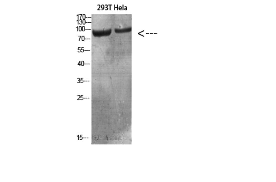 Western Blot - Anti-IL4R Antibody (C30425) - Antibodies.com
