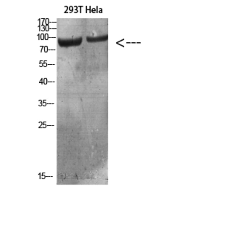 Western Blot - Anti-IL4R Antibody (C30425) - Antibodies.com