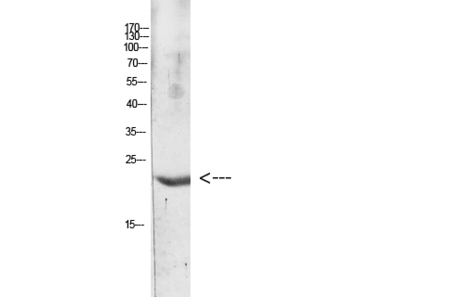 Western Blot - Anti-IL31 Antibody (C30674) - Antibodies.com