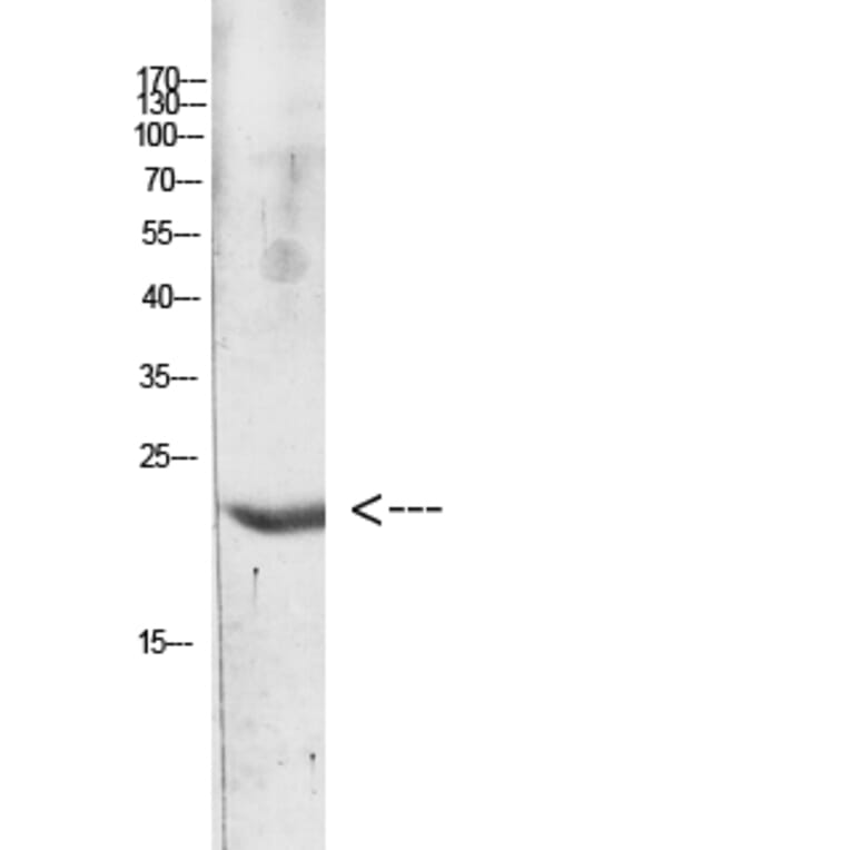 Western Blot - Anti-IL31 Antibody (C30674) - Antibodies.com
