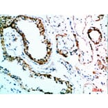 Immunohistochemistry - Anti-IL31 Antibody (C30674) - Antibodies.com
