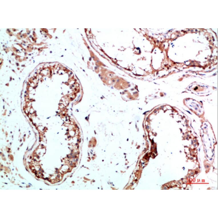Immunohistochemistry - Anti-IL31 Antibody (C30674) - Antibodies.com