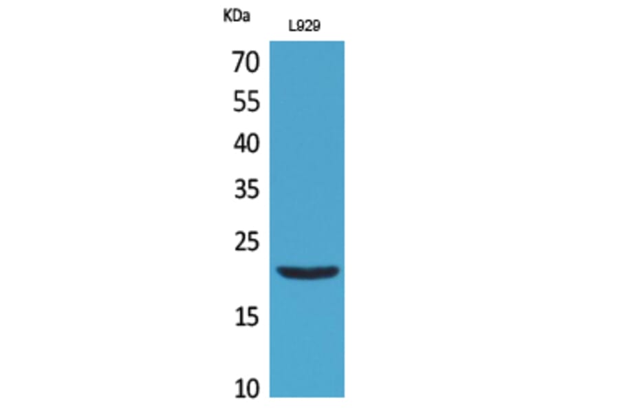 Western Blot - Anti-IL29 Antibody (C30618) - Antibodies.com