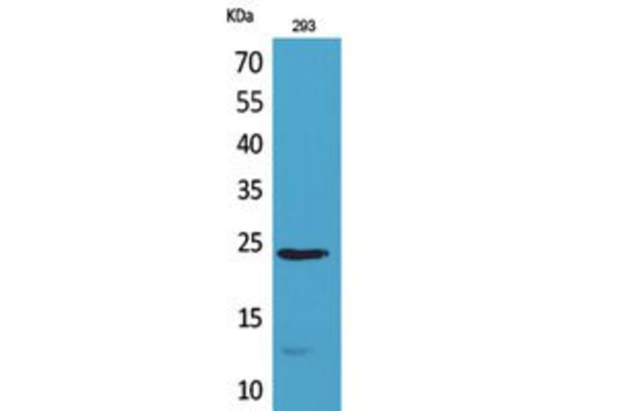 Western Blot - Anti-IL24 Antibody (C30602) - Antibodies.com