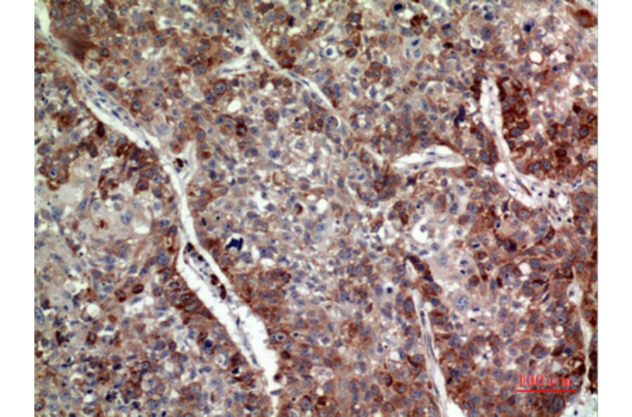 Immunohistochemistry - Anti-IL24 Antibody (C30602) - Antibodies.com