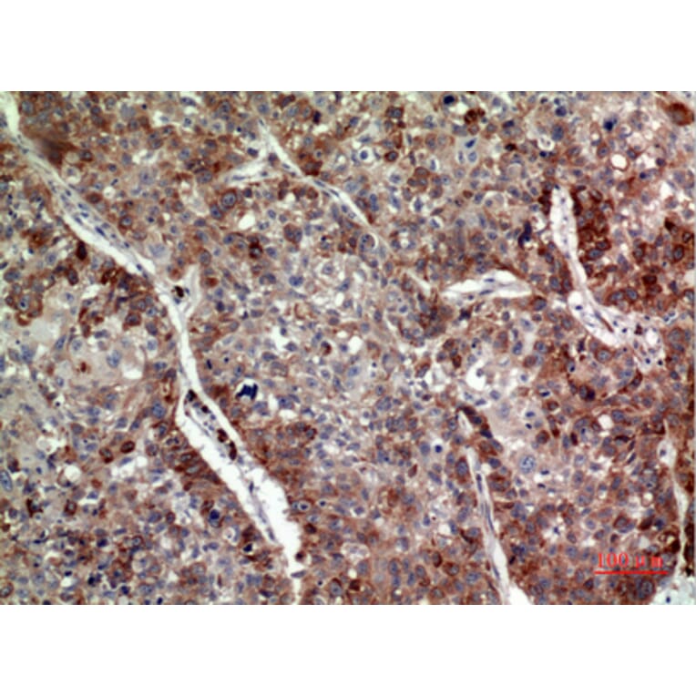 Immunohistochemistry - Anti-IL24 Antibody (C30602) - Antibodies.com