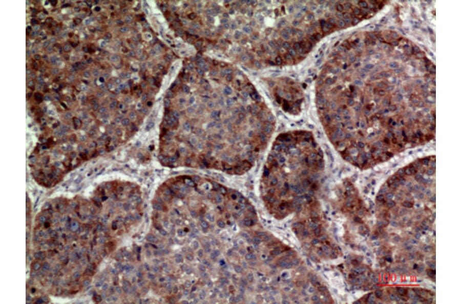 Immunohistochemistry - Anti-IL24 Antibody (C30602) - Antibodies.com