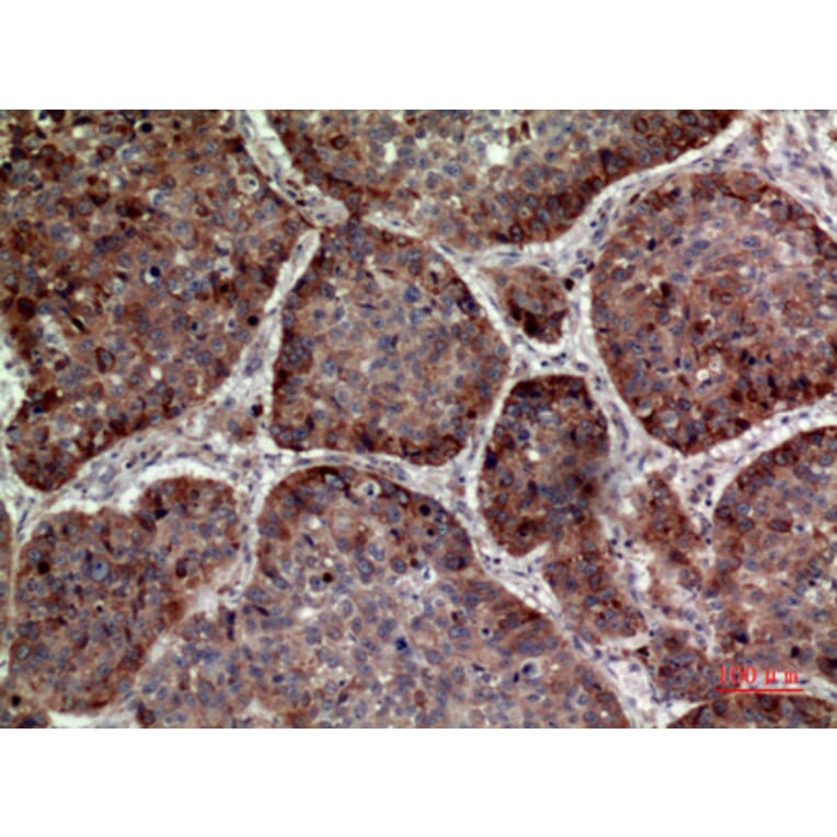 Immunohistochemistry - Anti-IL24 Antibody (C30602) - Antibodies.com