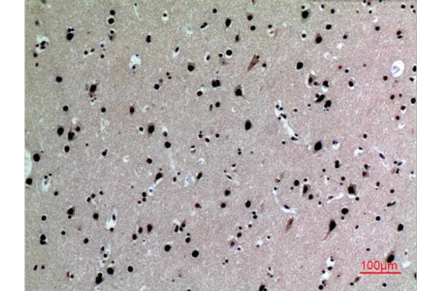 Immunohistochemistry - Anti-IL16 Antibody (C30095) - Antibodies.com