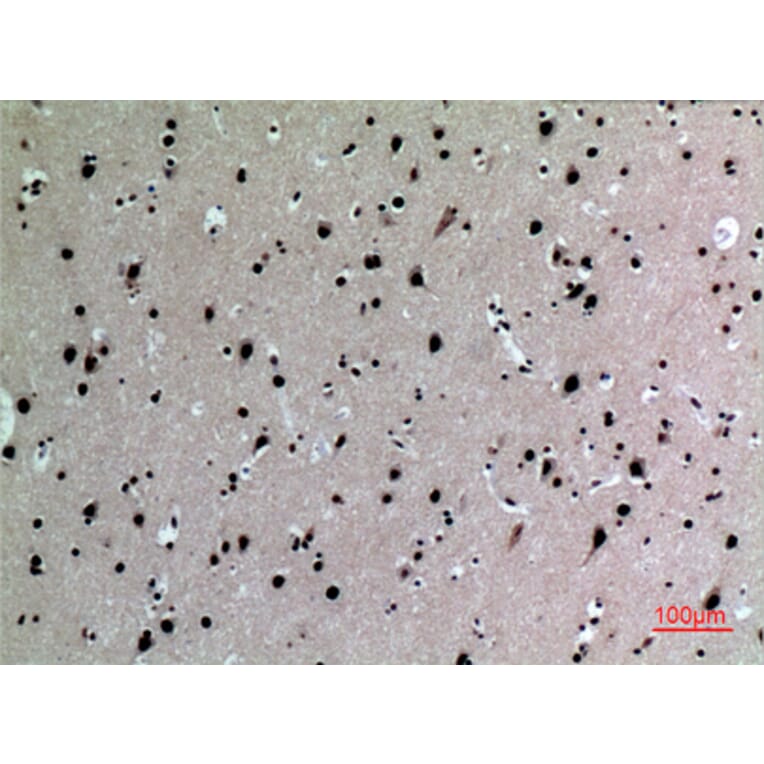 Immunohistochemistry - Anti-IL16 Antibody (C30095) - Antibodies.com