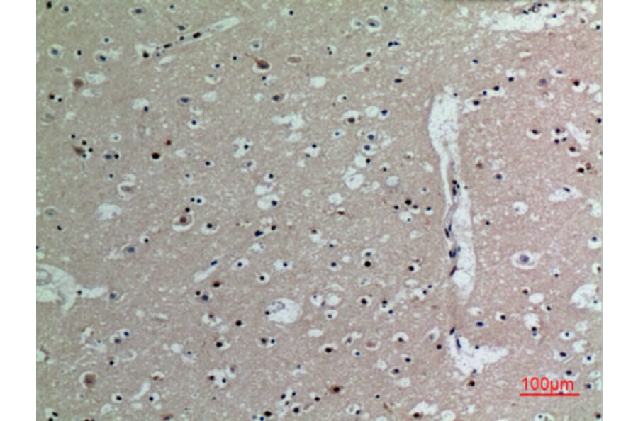 Immunohistochemistry - Anti-IL16 Antibody (C30095) - Antibodies.com