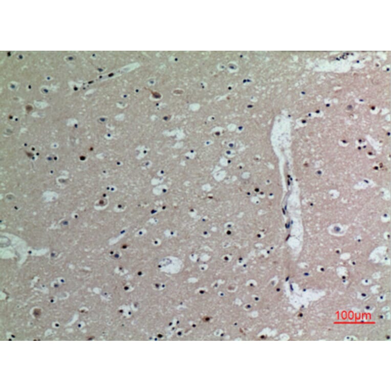 Immunohistochemistry - Anti-IL16 Antibody (C30095) - Antibodies.com