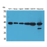 Western Blot - Anti-IL10 Antibody (C30001) - Antibodies.com