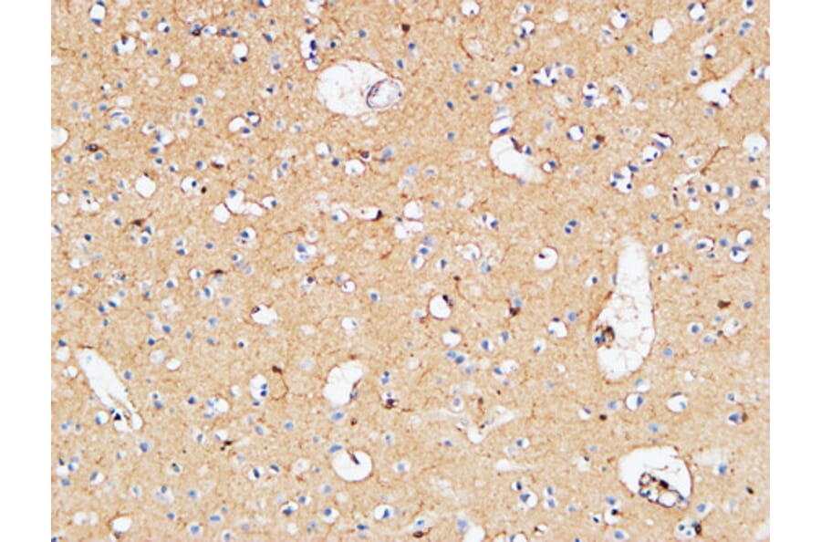 Immunohistochemistry - Anti-IL10 Antibody (C30001) - Antibodies.com