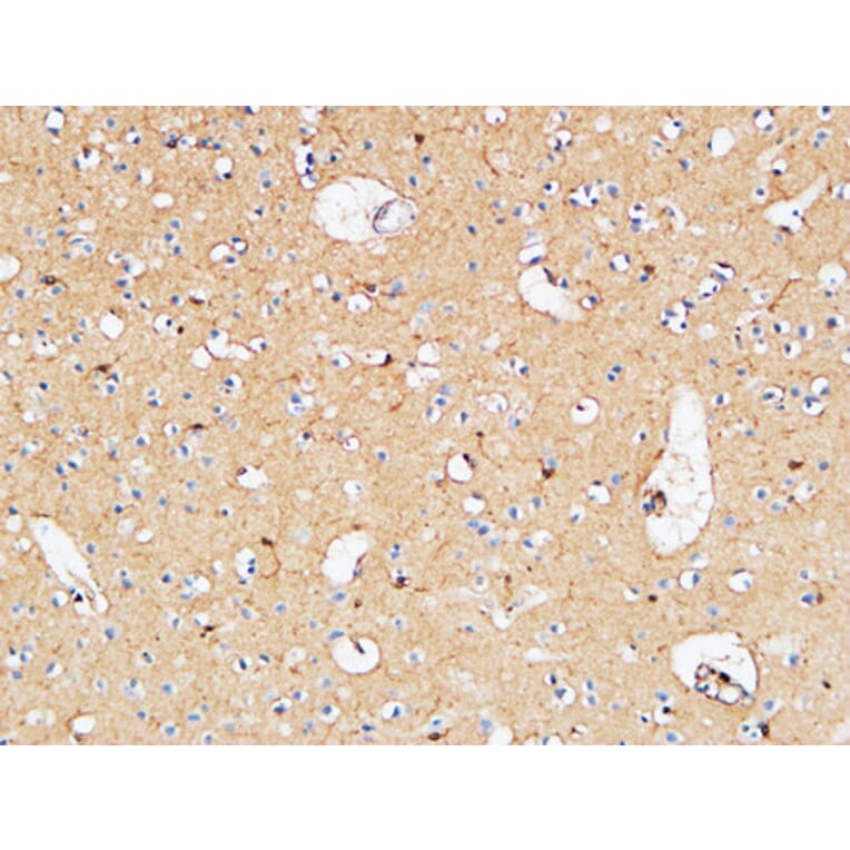 Immunohistochemistry - Anti-IL10 Antibody (C30001) - Antibodies.com