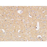 Immunohistochemistry - Anti-IL10 Antibody (C30001) - Antibodies.com