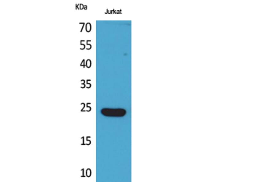 Western Blot - Anti-IFNE Antibody (C30668) - Antibodies.com