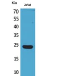 Western Blot - Anti-IFNE Antibody (C30668) - Antibodies.com