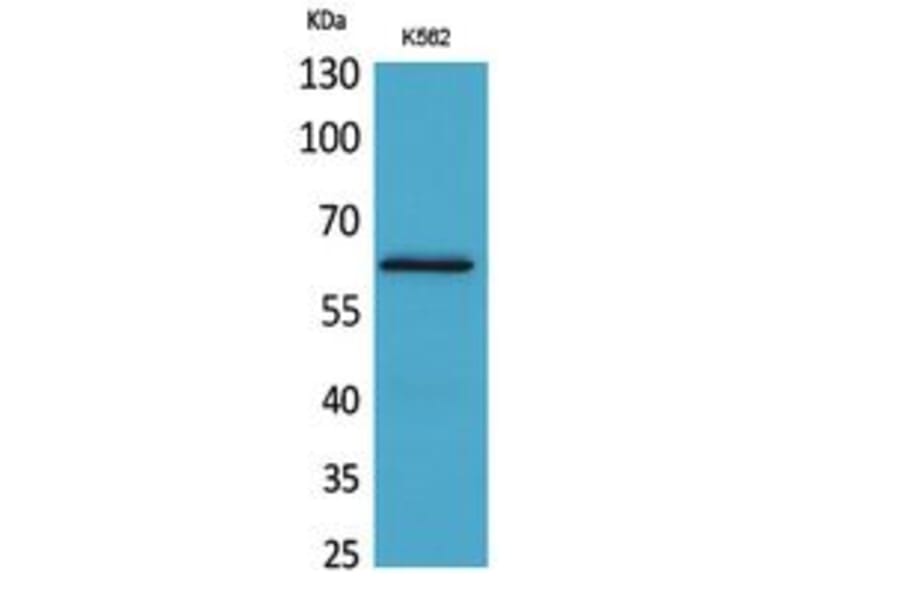 Western Blot - Anti-HPSE Antibody (C30023) - Antibodies.com