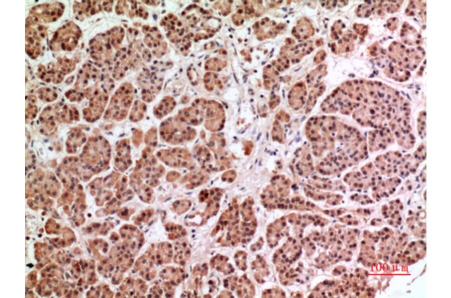 Immunohistochemistry - Anti-HPSE Antibody (C30023) - Antibodies.com