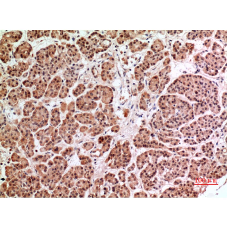 Immunohistochemistry - Anti-HPSE Antibody (C30023) - Antibodies.com