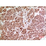 Immunohistochemistry - Anti-HPSE Antibody (C30023) - Antibodies.com