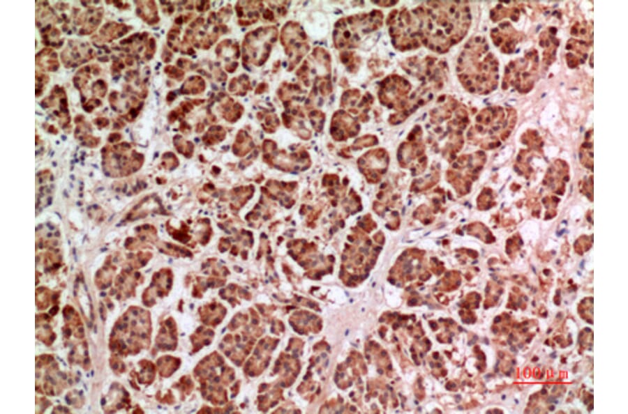 Immunohistochemistry - Anti-HPSE Antibody (C30023) - Antibodies.com