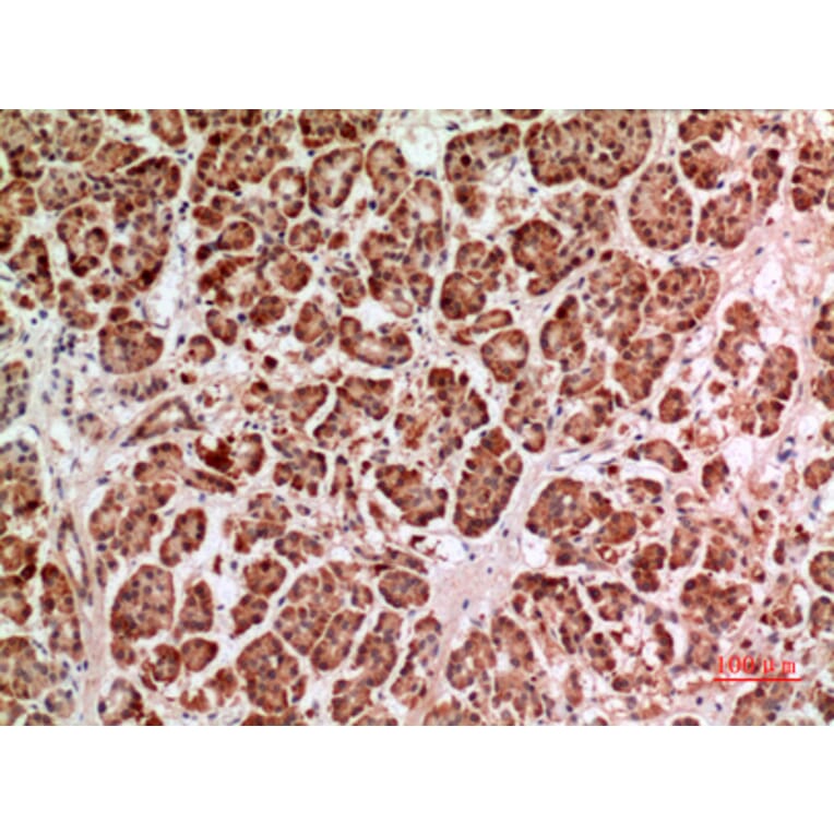 Immunohistochemistry - Anti-HPSE Antibody (C30023) - Antibodies.com